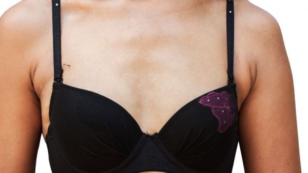 乳房脹痛嚴(yán)重嗎