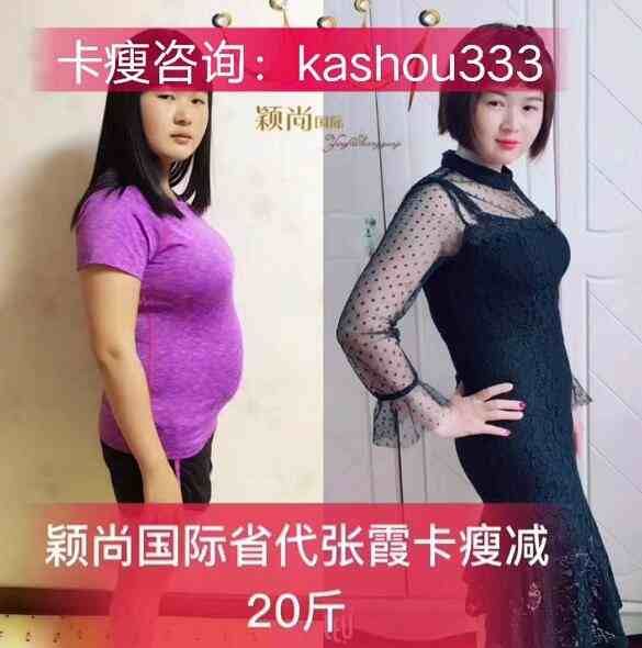 張霞對(duì)比照