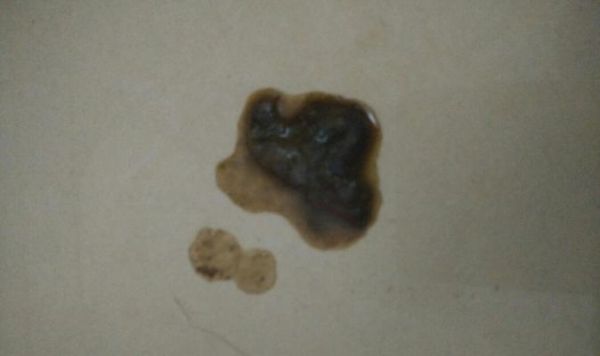 小泰迪一个月拉屎太多怎么办（宠物健康的重要性与注意事项）