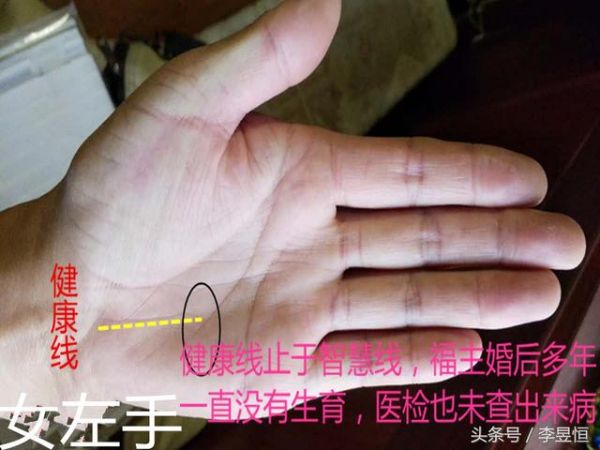 手相中健康線的出現(xiàn)，千萬不可忽視！