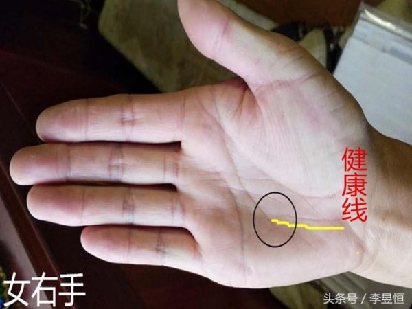 手相中健康線的出現(xiàn)，千萬不可忽視！