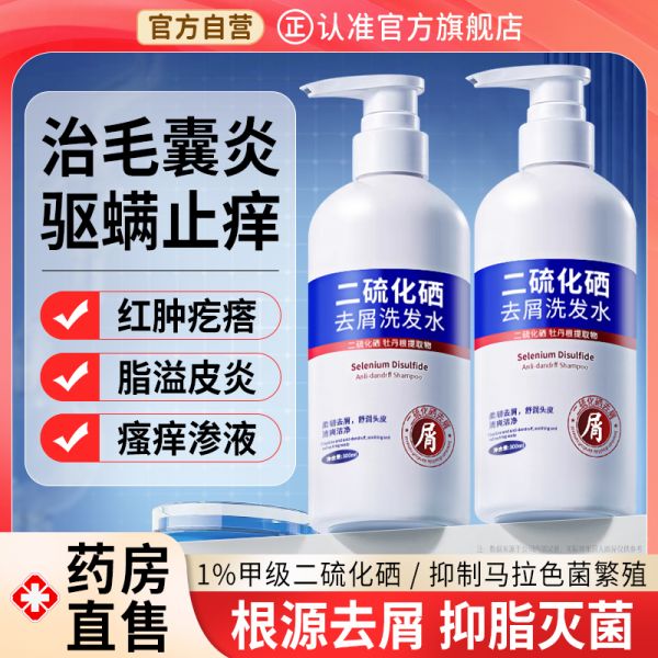 【若安好洗发水50】头皮不健康如何调养：二硫化硒洗发水液去屑止痒控油蓬松洗头膏毛囊清洁炎露男女非除螨45760
