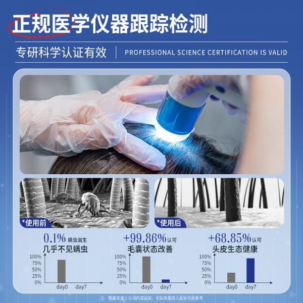 【若安好洗发水50】头皮不健康如何调养：二硫化硒洗发水液去屑止痒控油蓬松洗头膏毛囊清洁炎露男女非除螨45762