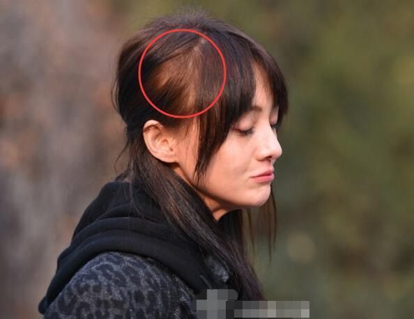 郑爽暴瘦之后又开始严重脱发？网曝微微一笑很倾城里全戴假发