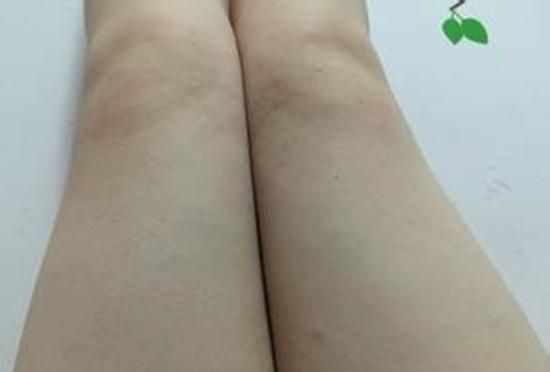 瘦腿法大全：各種粗腿兩周秒瘦3~5厘米！