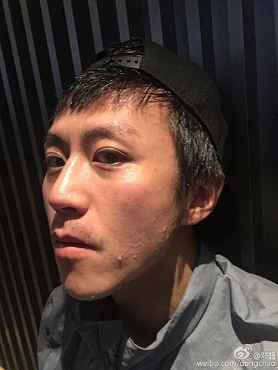鄧超暴瘦孫儷心疼不已 鄧超現(xiàn)在體重多少斤 超哥為了拍戲好拼