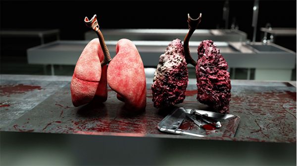 治療早期肺癌，伽瑪刀能否超越手術