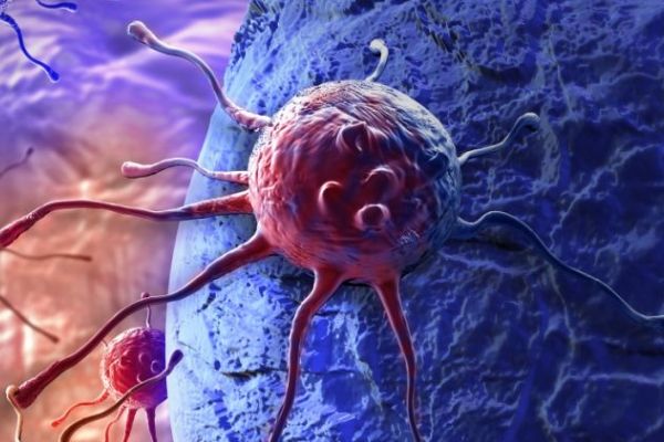 女人夜间盗汗是什么病 夜间盗汗是什么原因女性 长期盗汗和什么病有关