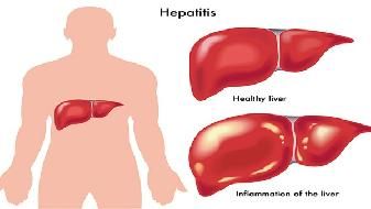 吐血不重视 这可能是胃癌的症状