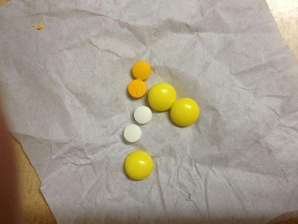 5岁女儿突然暴瘦，拍片时医生让孩子摘下项链，妈妈：她没戴项链