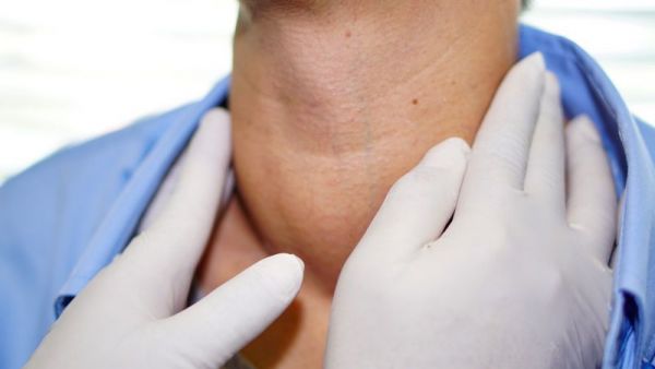 亚急性甲状腺炎患者的饮食禁忌