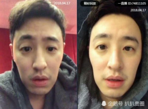潘瑋柏暴瘦怎么回事？潘瑋柏得了什么?。孔云匦呐K出問題！
