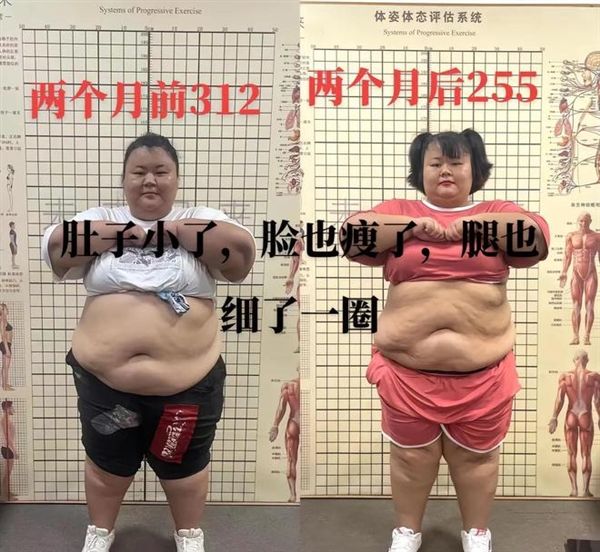 312斤女網(wǎng)紅在減肥營(yíng)離世：2個(gè)月內(nèi)暴瘦57斤