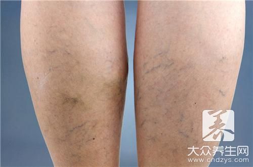 手掌出現(xiàn)青筋與顏色看一個(gè)人的健康
