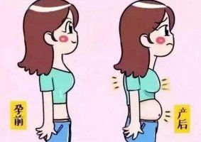 腹直肌分離怎么恢復