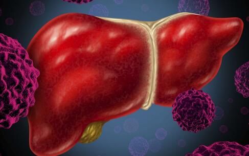 治疗 乙肝 食疗