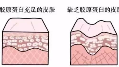 減肥如何不減胸？（如何瘦身不瘦胸）