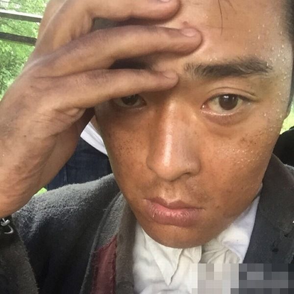 張桐暴瘦原因成謎