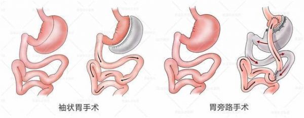 疫情過去人人成了美食家？！復(fù)工后發(fā)現(xiàn)體重暴漲怎么減肥？