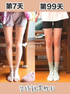 運(yùn)動(dòng)打卡第99天矯正小腿外翻+腹部減脂