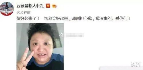 49歲韓紅近照曝光,低調(diào)現(xiàn)身活動(dòng),身材暴瘦引人擔(dān)憂