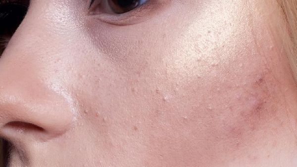 冬季瘦身湯有哪些？推薦5款冬季瘦身湯即可甩肉又美容
