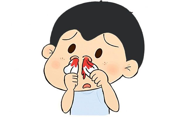 流鼻血,流鼻血怎么办