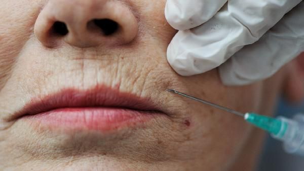 如何瘦脸部的咬肌