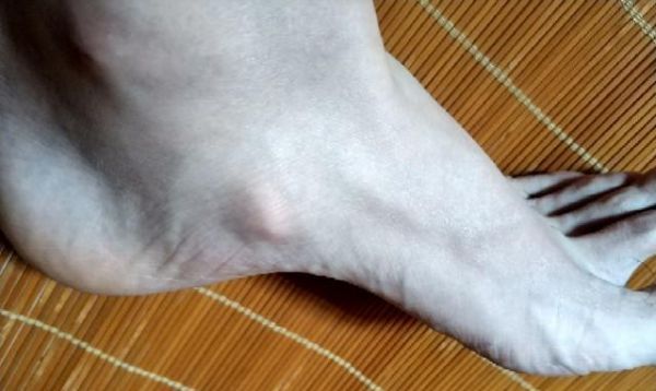 揭秘貓咪大腿內(nèi)側(cè)突出骨頭的真相（以寵物為主）