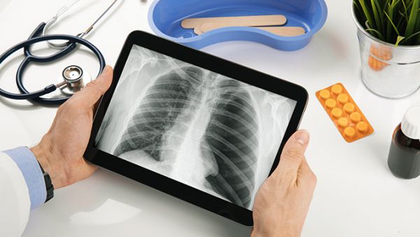 肺癌轉(zhuǎn)移到胰腺的癥狀