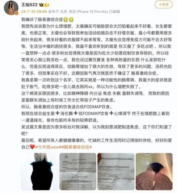 杜淳老婆增肥成功 從病痛到健康的華麗轉(zhuǎn)身