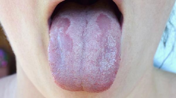 早晨怎么吃水果才能减肥健康
