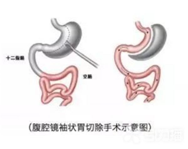 引力播