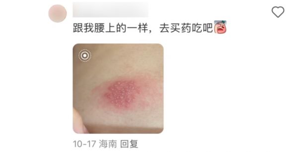 好端端減個(gè)肥結(jié)果變成“痛不欲生”， 醫(yī)生：這些“傻事”別干