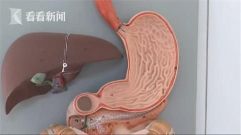 “兔子”網(wǎng)購插管催吐 少女暴瘦至30多公斤住院