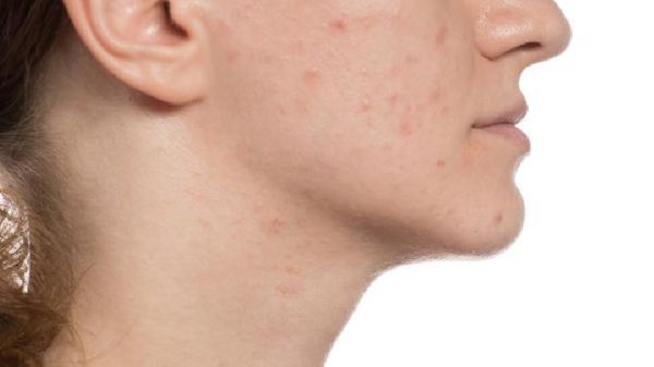 脸胖身体却不胖是怎么回事?是否犯了这些小毛病