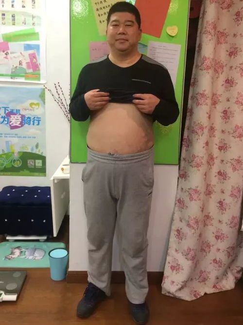 只因被女兒說胖男子3個月減重60斤_因女兒說胖，浙江一男子減重60斤，網(wǎng)友:判若兩人