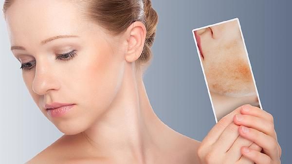 怎樣瘦臉頰上的肉