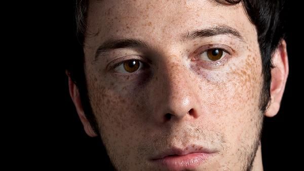 怎樣瘦臉頰上的肉