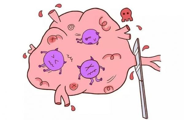 女子節(jié)食暴瘦44斤想“餓死”腫瘤