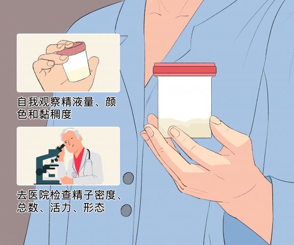 怎么測精子質(zhì)量.png