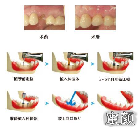https://img.miyanlife.com/mnt/timg/201228/105U55410-6.jpg