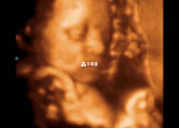 彩超不能看出寶寶性別