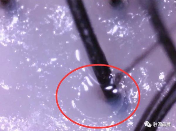 年輕人，你的頭發(fā)為什么越來越少？