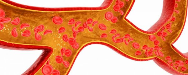 身体出现三个表现说明血管变硬了 血管变硬怎么办 身体出现什么表现说明血管变硬了