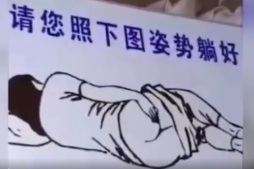 做肛拭子檢測(cè)需要插多深？有痔瘡能做嗎？衛(wèi)健委科普回應(yīng)