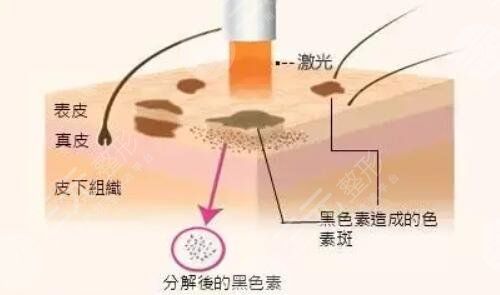 现在的医美技术也发展的很不错