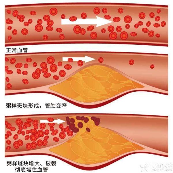 血管健康插圖.jpg