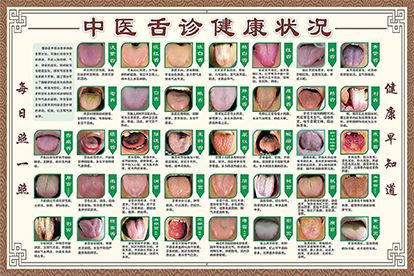 舌苔圖