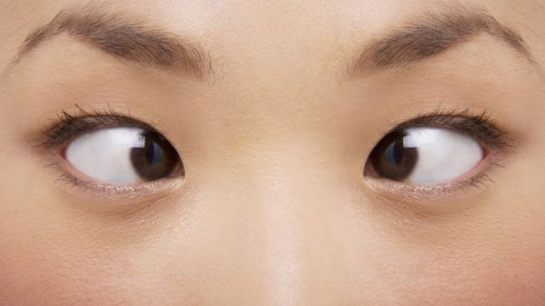 怎么判斷是不是對眼
